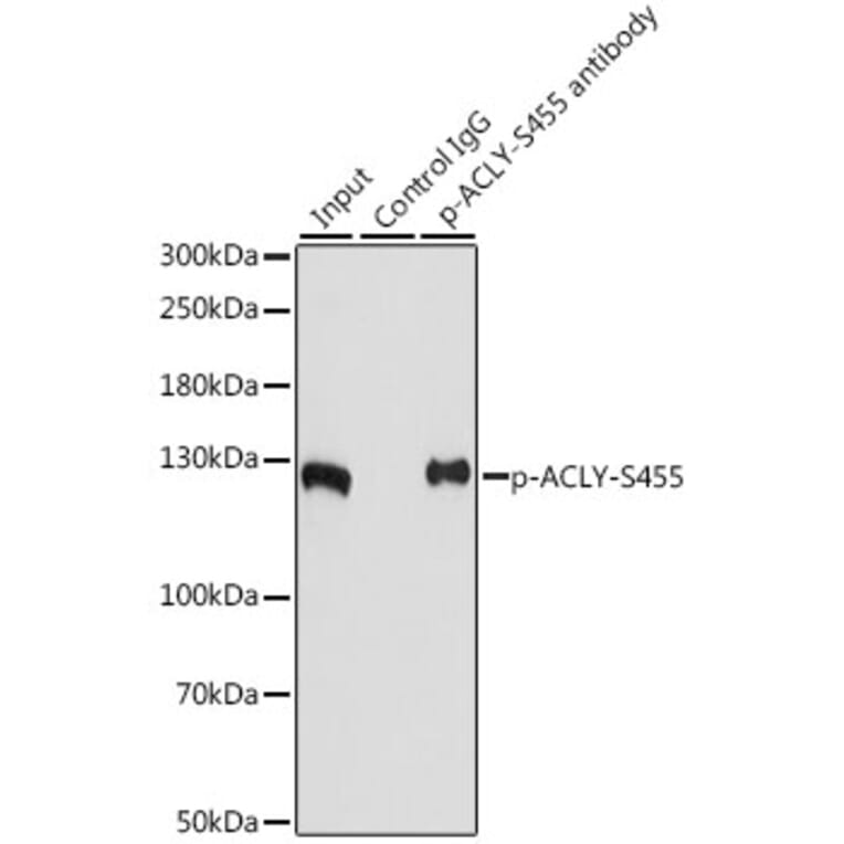 Western Blot - Anti-ATP citrate lyase (phospho Ser455) Antibody (A88061) - Antibodies.com