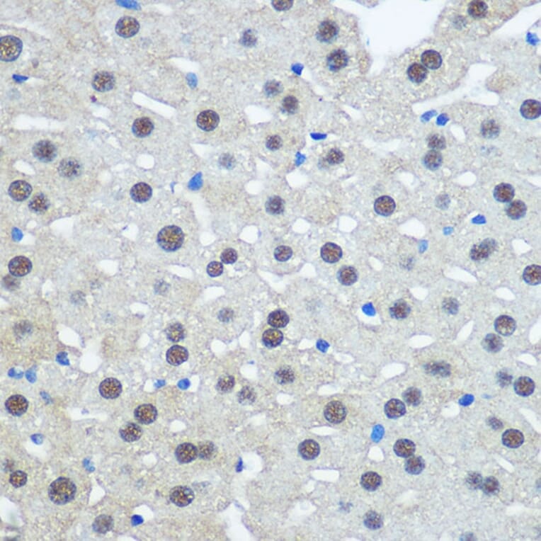 Immunohistochemistry - Anti-E1 Ubiquitin Activating Enzyme 1/UBA1 Antibody (A88062) - Antibodies.com