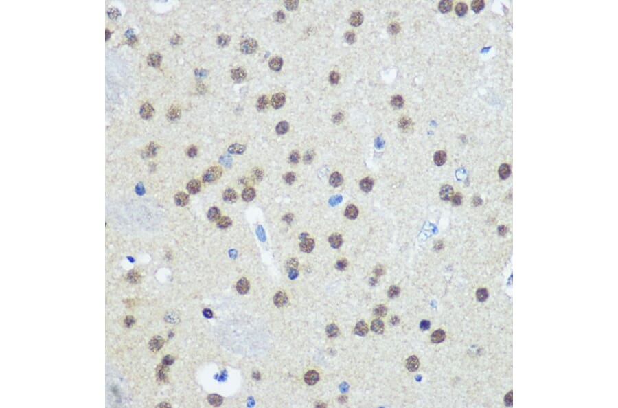 Immunohistochemistry - Anti-E1 Ubiquitin Activating Enzyme 1/UBA1 Antibody (A88062) - Antibodies.com