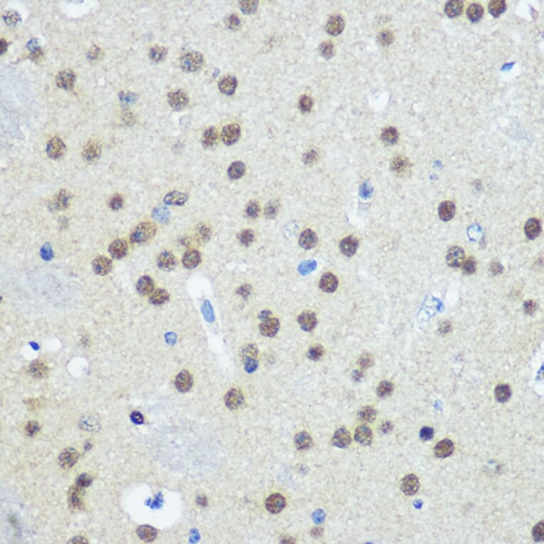 Immunohistochemistry - Anti-E1 Ubiquitin Activating Enzyme 1/UBA1 Antibody (A88062) - Antibodies.com