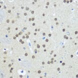 Immunohistochemistry - Anti-E1 Ubiquitin Activating Enzyme 1/UBA1 Antibody (A88062) - Antibodies.com