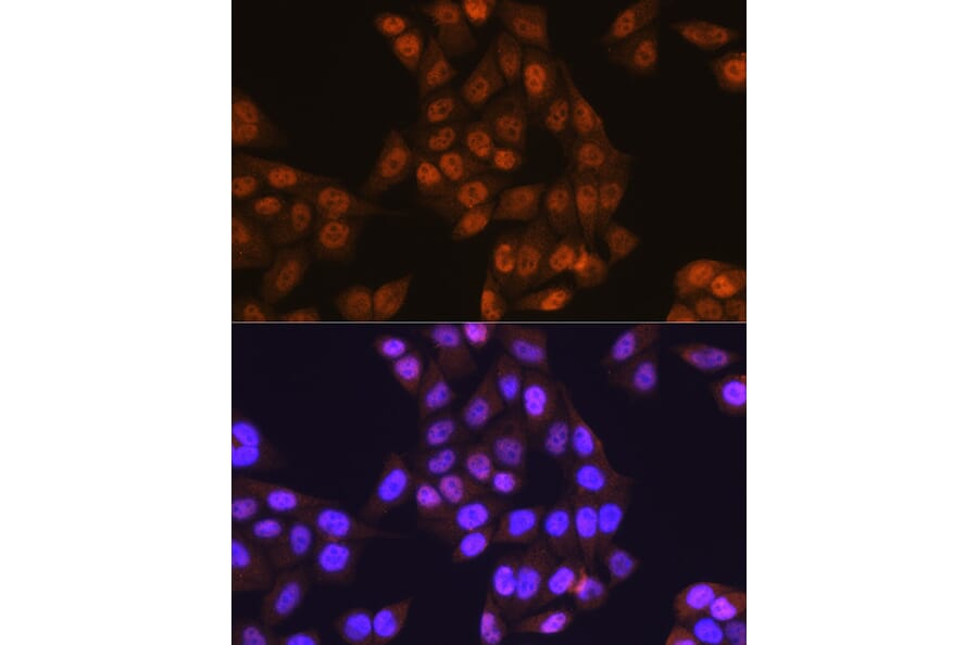 Immunofluorescence - Anti-E1 Ubiquitin Activating Enzyme 1/UBA1 Antibody (A88062) - Antibodies.com