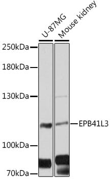 Western blot analysis of extracts of various cell lines, using Anti-EPB41L3 Antibody (A12759) at 1:3000 dilution.
Secondary antibody: Goat Anti-Rabbit IgG (H+L) (HRP) (AS014) at 1:10,000 dilution.
Lysates / proteins: 25µg per lane.
Blocking buffer: 3% non-fat dry milk in TBST.
Detection: ECL Basic Kit (RM00020).
Exposure time: 30s.