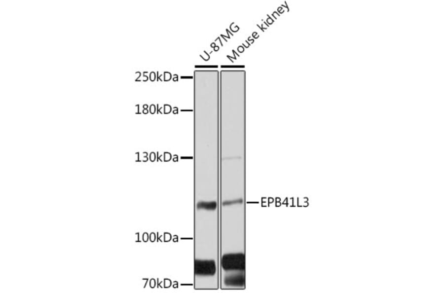 Western Blot - Anti-EPB41L3/DAL1 Antibody (A88063) - Antibodies.com