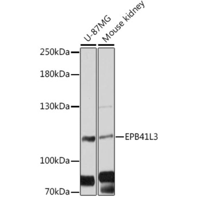 Western Blot - Anti-EPB41L3/DAL1 Antibody (A88063) - Antibodies.com