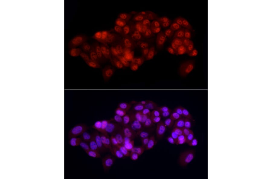 Immunofluorescence - Anti-SREBP1 Antibody (A88065) - Antibodies.com