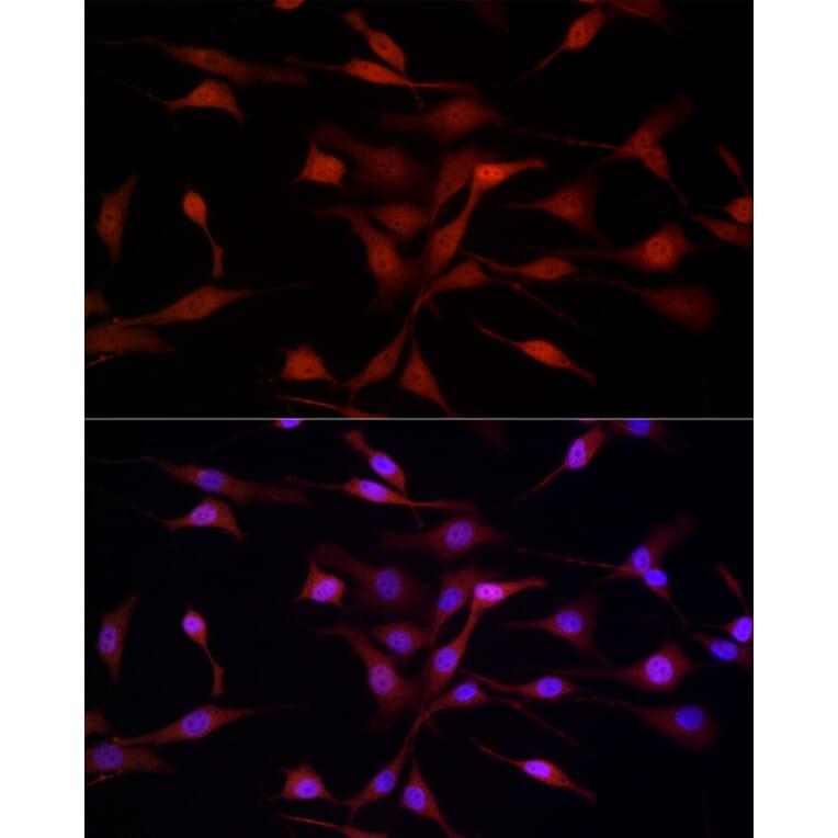 Immunofluorescence - Anti-SREBP1 Antibody (A88065) - Antibodies.com