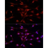 Immunofluorescence - Anti-SREBP1 Antibody (A88065) - Antibodies.com