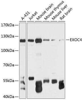 Western blot analysis of extracts of various cell lines, using Anti-EXOC4 Antibody (A12374) at 1:3000 dilution.
Secondary antibody: Goat Anti-Rabbit IgG (H+L) (HRP) (AS014) at 1:10,000 dilution.
Lysates / proteins: 25µg per lane.
Blocking buffer: 3% non-fat dry milk in TBST.
Detection: ECL Basic Kit (RM00020).
Exposure time: 1s.