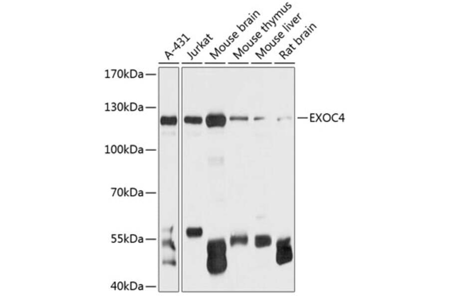 Western Blot - Anti-Sec8 Antibody (A88066) - Antibodies.com