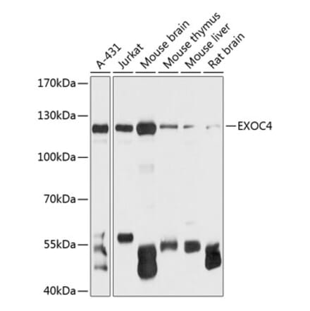 Western Blot - Anti-Sec8 Antibody (A88066) - Antibodies.com