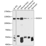 Western Blot - Anti-Sec8 Antibody (A88066) - Antibodies.com