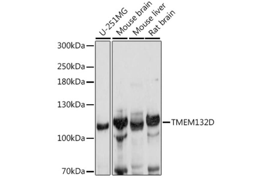 Western Blot - Anti-TMEM132D Antibody (A88067) - Antibodies.com