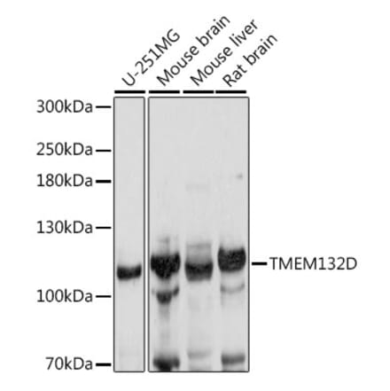 Western Blot - Anti-TMEM132D Antibody (A88067) - Antibodies.com