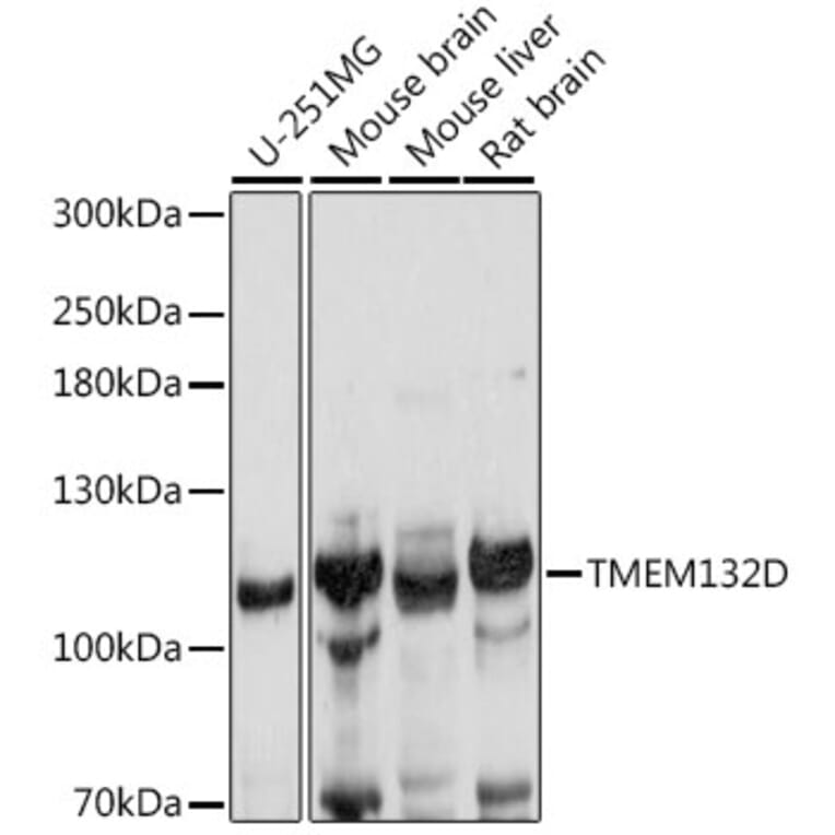 Western Blot - Anti-TMEM132D Antibody (A88067) - Antibodies.com