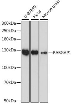 Western blot analysis of extracts of various cell lines, using Anti-RABGAP1 Antibody (A15804) at 1:1,000 dilution.
Secondary antibody: Goat Anti-Rabbit IgG (H+L) (HRP) (AS014) at 1:10,000 dilution.
Lysates / proteins: 25µg per lane.
Blocking buffer: 3% non-fat dry milk in TBST.
Detection: ECL Basic Kit (RM00020).
Exposure time: 90s.