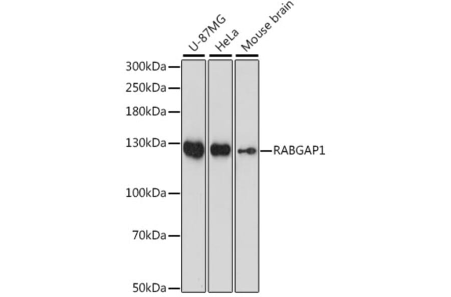 Western Blot - Anti-RABGAP1 Antibody (A88068) - Antibodies.com