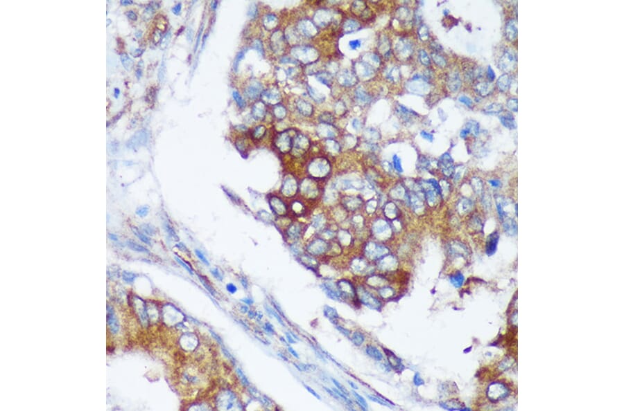 Immunohistochemistry - Anti-RABGAP1 Antibody (A88068) - Antibodies.com
