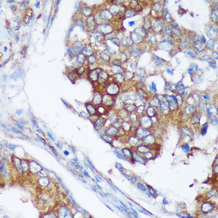 Immunohistochemistry - Anti-RABGAP1 Antibody (A88068) - Antibodies.com