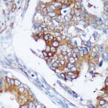 Immunohistochemistry - Anti-RABGAP1 Antibody (A88068) - Antibodies.com
