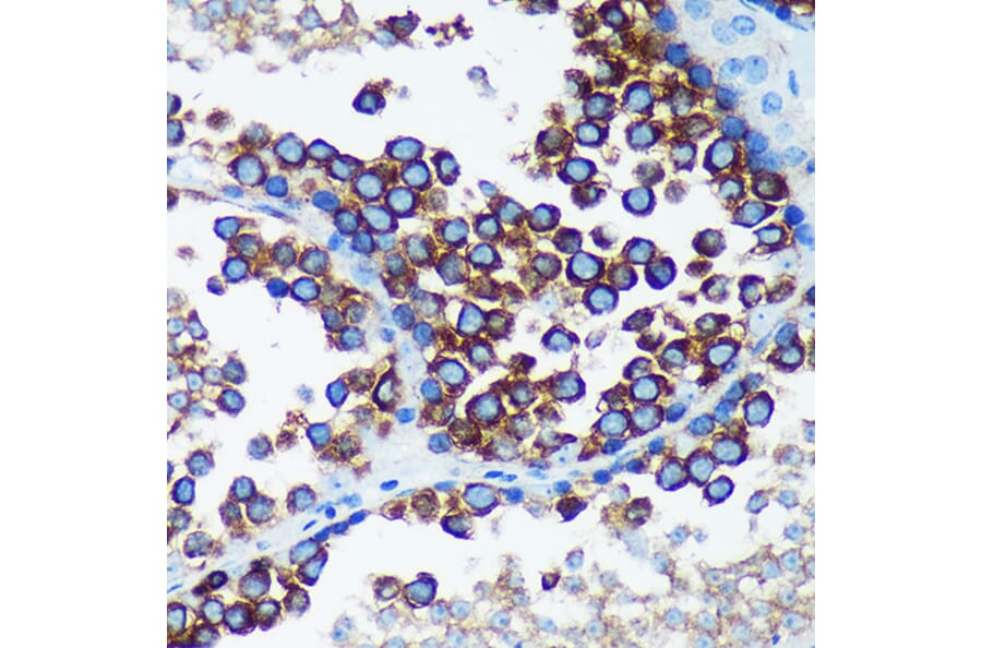 Immunohistochemistry - Anti-RABGAP1 Antibody (A88068) - Antibodies.com
