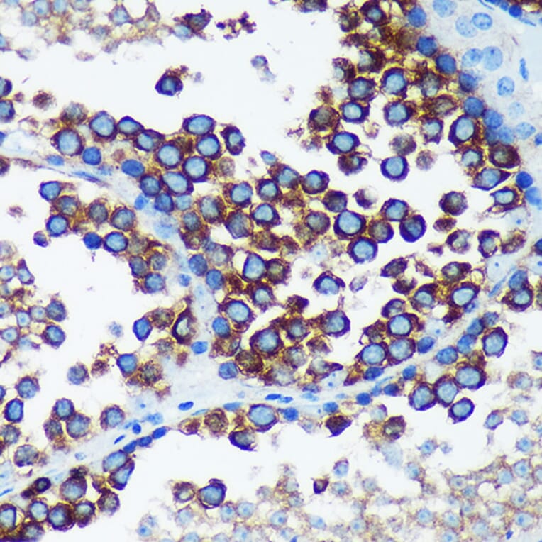 Immunohistochemistry - Anti-RABGAP1 Antibody (A88068) - Antibodies.com