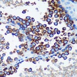 Immunohistochemistry - Anti-RABGAP1 Antibody (A88068) - Antibodies.com