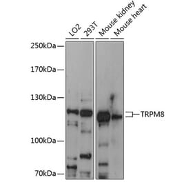 Western Blot - Anti-TRPM8 Antibody (A88069) - Antibodies.com