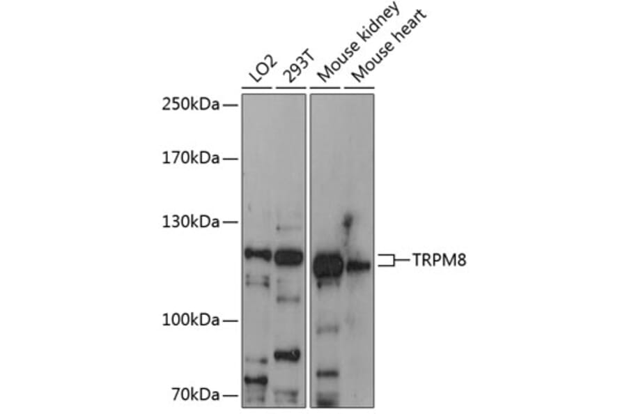 Western Blot - Anti-TRPM8 Antibody (A88069) - Antibodies.com