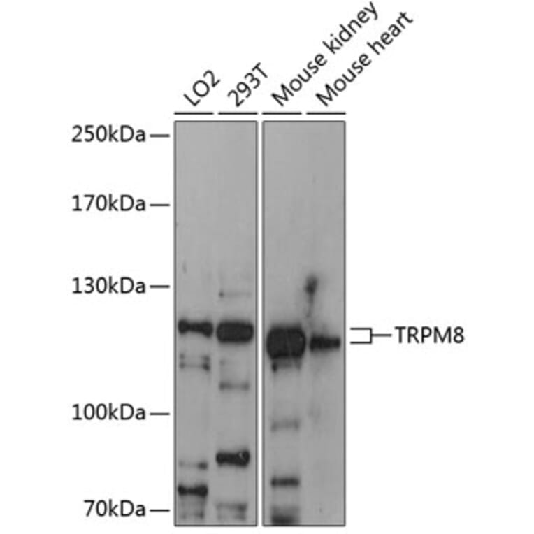 Western Blot - Anti-TRPM8 Antibody (A88069) - Antibodies.com