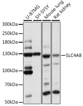 Western blot analysis of extracts of various cell lines, using Anti-SLC4A8 Antibody (A14825) at 1:1,000 dilution.
Secondary antibody: Goat Anti-Rabbit IgG (H+L) (HRP) (AS014) at 1:10,000 dilution.
Lysates / proteins: 25µg per lane.
Blocking buffer: 3% non-fat dry milk in TBST.
Detection: ECL Basic Kit (RM00020).
Exposure time: 1s.