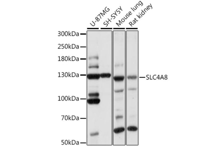 Western Blot - Anti-SLC4A8/NBC Antibody (A88071) - Antibodies.com