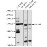Western Blot - Anti-SLC4A8/NBC Antibody (A88071) - Antibodies.com