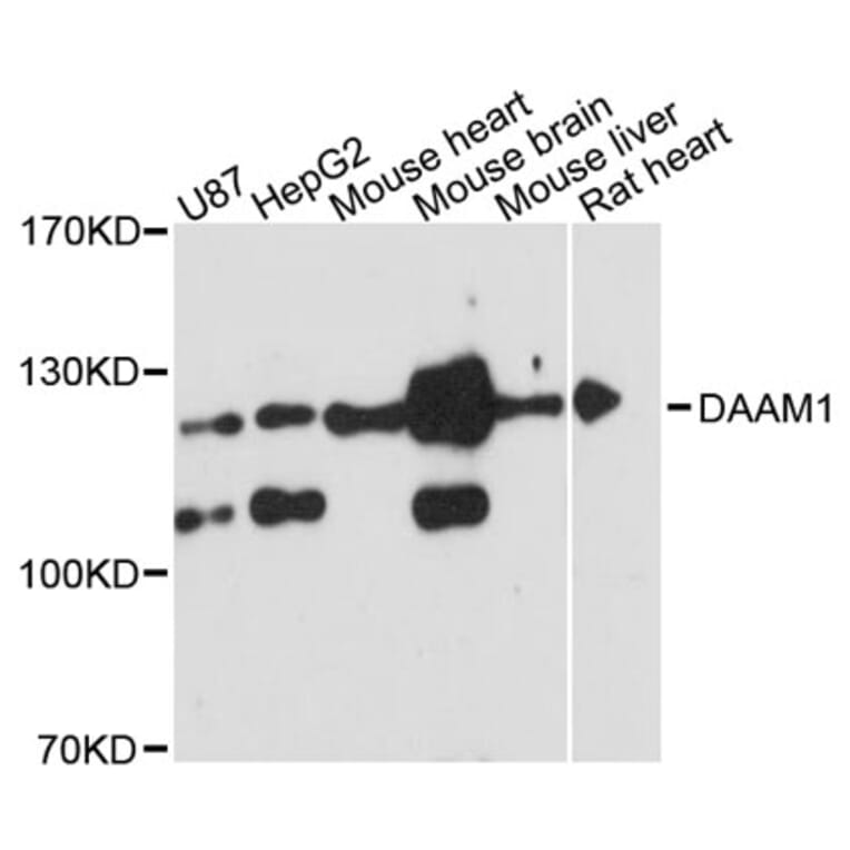 Western Blot - Anti-DAAM1 Antibody (A12929) - Antibodies.com