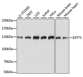Western Blot - Anti-E-Syt1 Antibody (A88074) - Antibodies.com