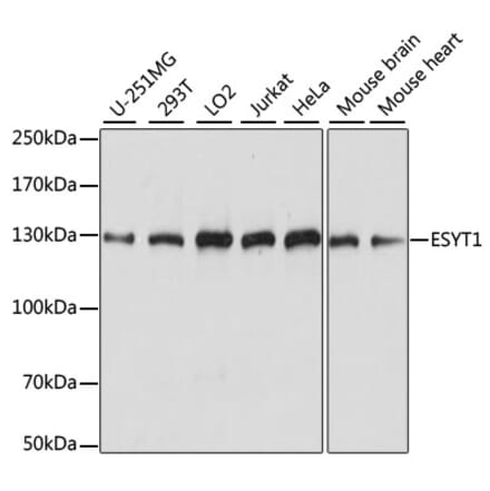 Western Blot - Anti-E-Syt1 Antibody (A88074) - Antibodies.com