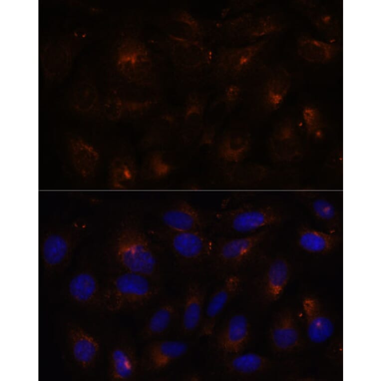 Immunofluorescence - Anti-E-Syt1 Antibody (A88074) - Antibodies.com