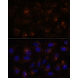 Immunofluorescence - Anti-E-Syt1 Antibody (A88074) - Antibodies.com