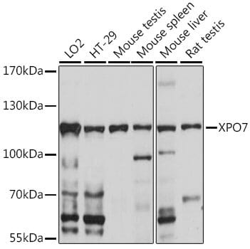 Western blot analysis of extracts of various cell lines, using Anti-XPO7 Antibody (A16108) at 1:1,000 dilution.
Secondary antibody: Goat Anti-Rabbit IgG (H+L) (HRP) (AS014) at 1:10,000 dilution.
Lysates / proteins: 25µg per lane.
Blocking buffer: 3% non-fat dry milk in TBST.
Detection: ECL Basic Kit (RM00020).
Exposure time: 10s.