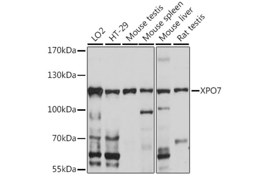 Western Blot - Anti-XPO7 Antibody (A88075) - Antibodies.com