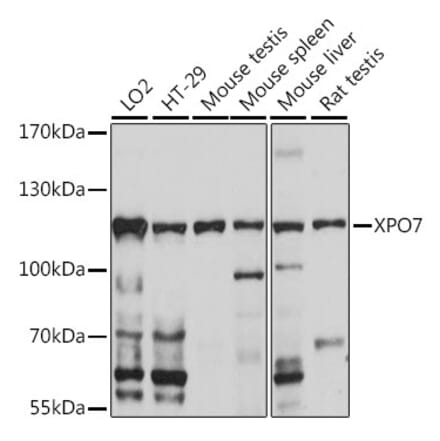 Western Blot - Anti-XPO7 Antibody (A88075) - Antibodies.com