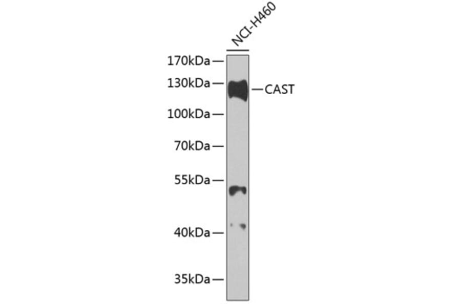 Western Blot - Anti-Calpastatin Antibody (A88076) - Antibodies.com