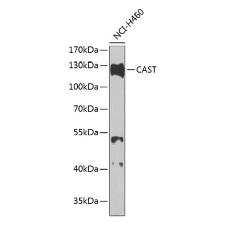 Western Blot - Anti-Calpastatin Antibody (A88076) - Antibodies.com
