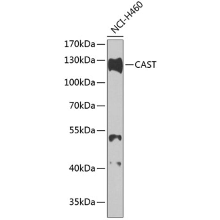 Western Blot - Anti-Calpastatin Antibody (A88076) - Antibodies.com