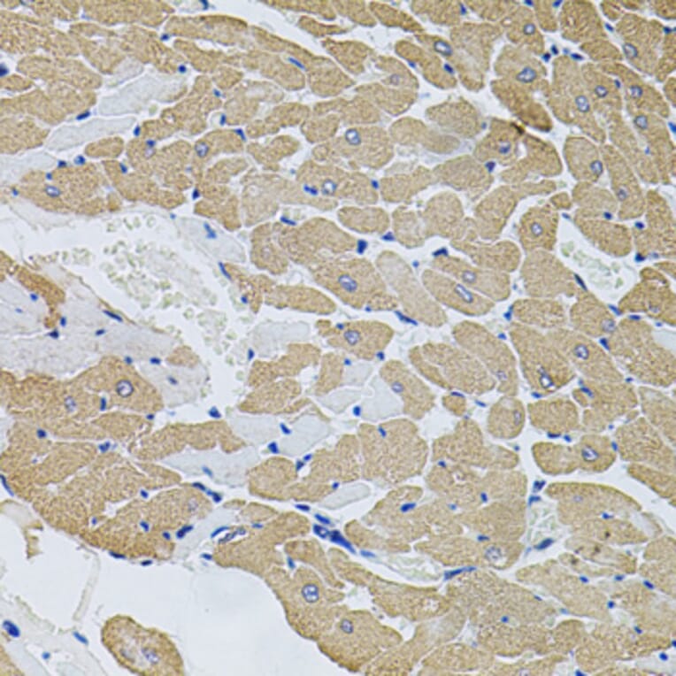 Immunohistochemistry - Anti-Calpastatin Antibody (A88076) - Antibodies.com