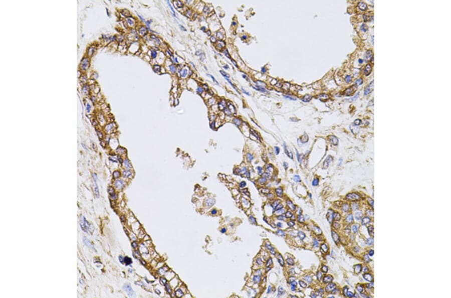 Immunohistochemistry - Anti-Calpastatin Antibody (A88076) - Antibodies.com