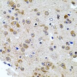 Immunohistochemistry - Anti-Calpastatin Antibody (A88076) - Antibodies.com