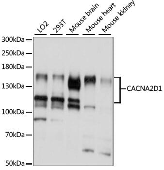 Western blot analysis of extracts of various cell lines, using Anti-CACNA2D1 Antibody (A15260) at 1:1,000 dilution.
Secondary antibody: Goat Anti-Rabbit IgG (H+L) (HRP) (AS014) at 1:10,000 dilution.
Lysates / proteins: 25µg per lane.
Blocking buffer: 3% non-fat dry milk in TBST.
Detection: ECL Basic Kit (RM00020).
Exposure time: 5S.