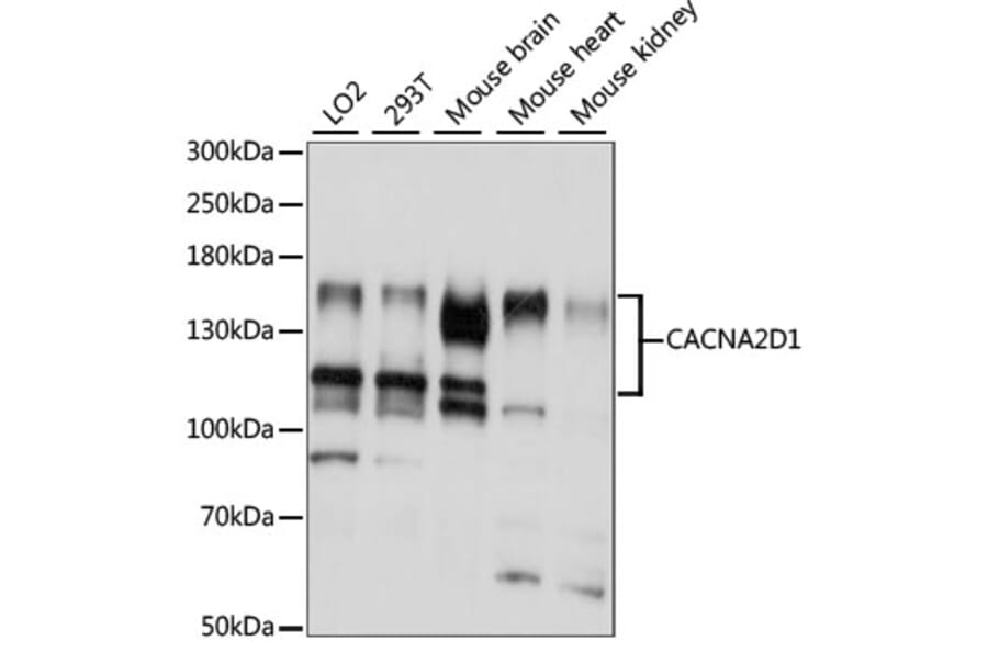 Western Blot - Anti-Calcium channel L type DHPR alpha 2 subunit/CACNA2D1 Antibody (A88077) - Antibodies.com