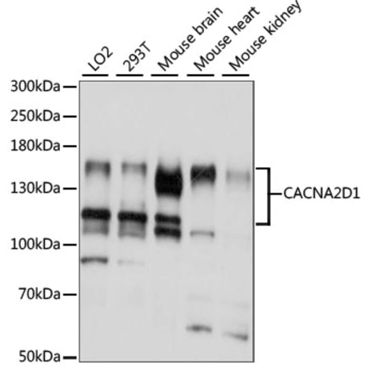 Western Blot - Anti-Calcium channel L type DHPR alpha 2 subunit/CACNA2D1 Antibody (A88077) - Antibodies.com
